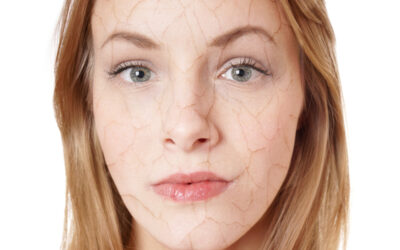 Skin Conditions That Can Hurt Your Self-Confidence
